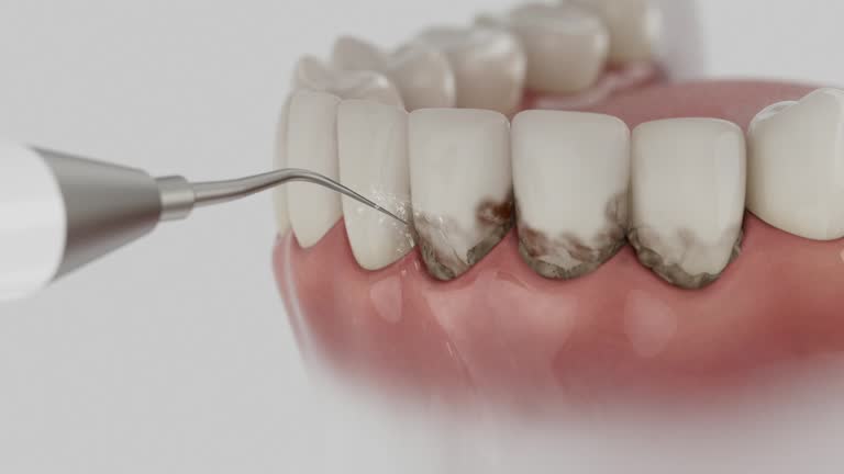 Trusted Teeth Cleaning And Checkup service in Lionville, PA - Dentist Open Now